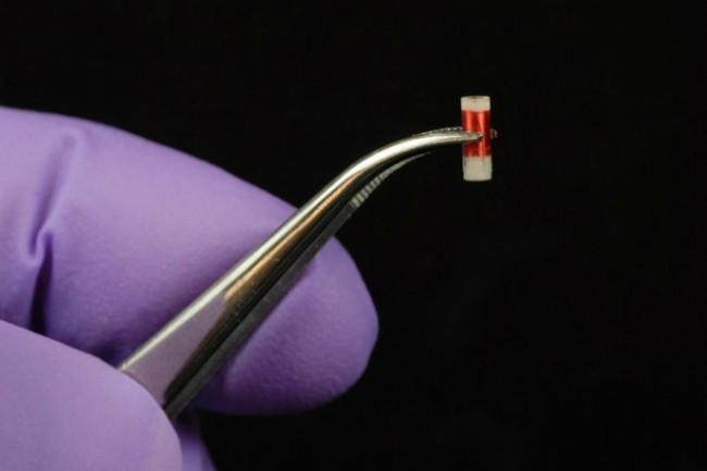 Kiçik implantat xərçəngin müalicəsinin gedişatını izləyə bilir