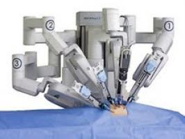 Robot mədəaltı vəz köçürür