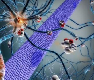 Beyinə implant edilən mikronasos epilepsiya xəstəliyini müalicə edəcək